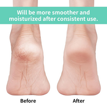 Infographic illustrating key features of the anti-crack silicone heel socks.